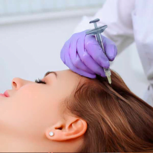 Intradermoterapia capilar