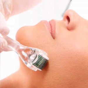 Microagulhamento Facial