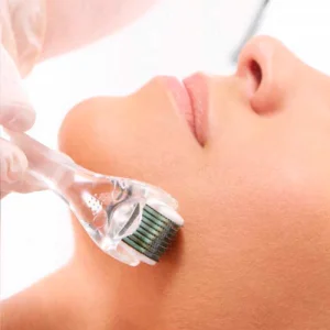 Microagulhamento Facial