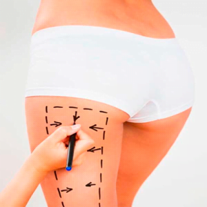Endermoterapia