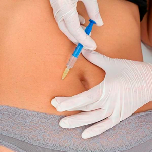 Intradermoterapia de Enzimas